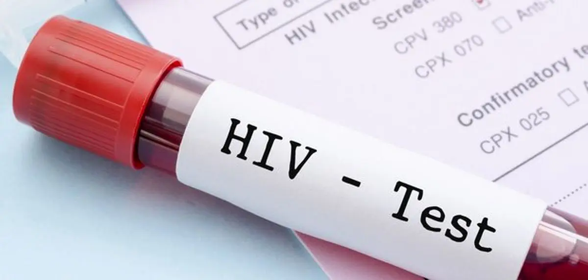 رئیس مرکز بیماری‌های واگیر: تتو غیربهداشتی می‌تواند HIV و هپاتیت منتقل کند