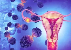 زنان این تست را حتما انجام دهند؛ سابقه خانوادگی خطر ابتلا را افزایش می‌دهد