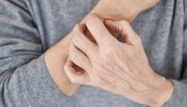 استرس ناشی از بحران و افزایش خشکی و التهاب پوست