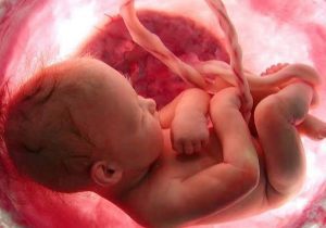 جنین ۲۳ هفته‌ای پس از جراحی خارج از رحم دوباره به رحم مادر بازگردانده شد