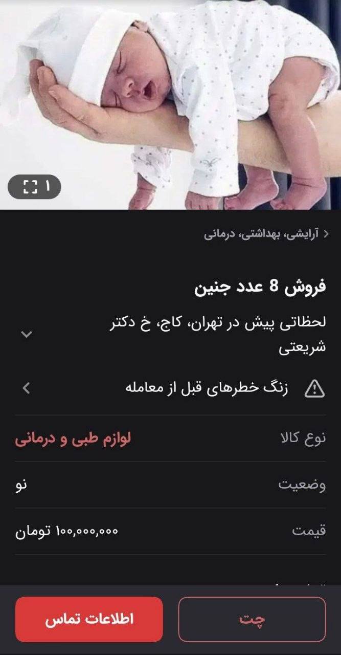 نوزاد ۱۰۰ میلیونی، چشم رنگی ها گرانتر؛ آگهی‌هایی که فضای مجازی را شوکه کرد